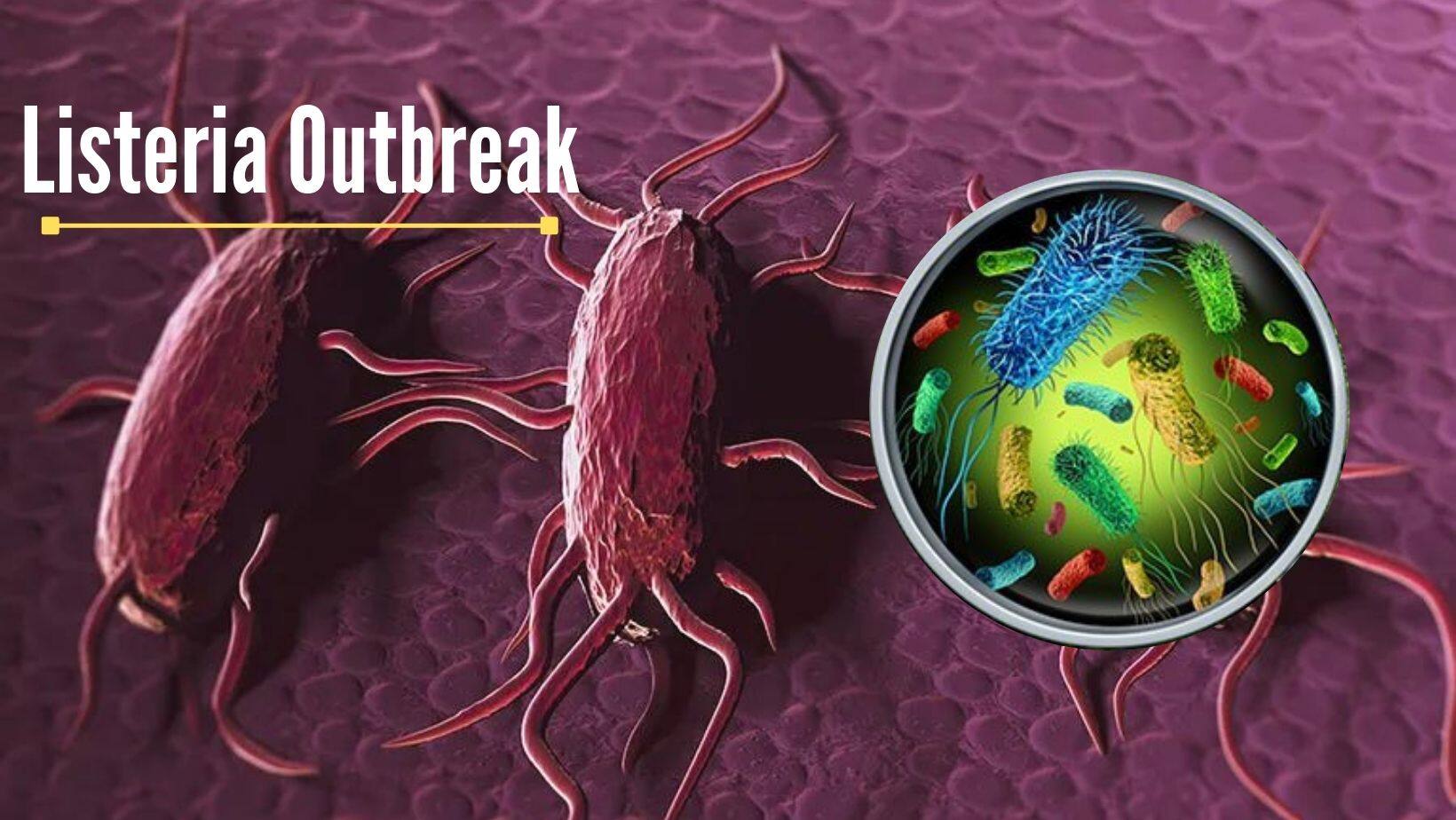 Listeria Outbreak In US: One Dead, Over Dozens Hospitalised; CDC Finds Link To Ice Cream Brand